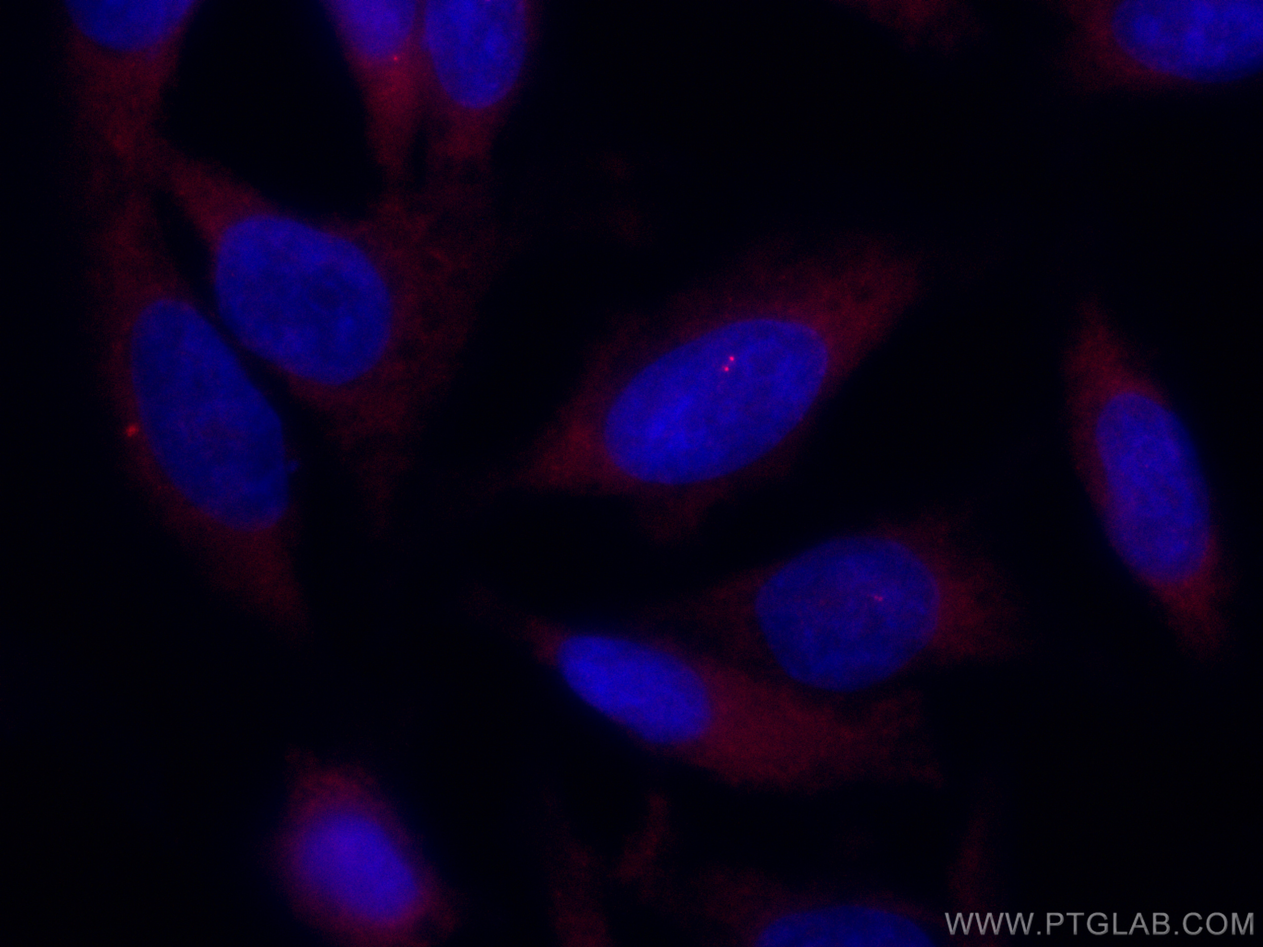 IF Staining of HeLa using CL594-12780