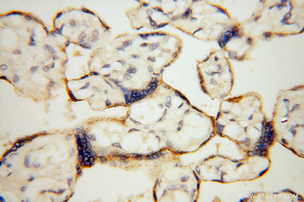 IHC staining of human placenta using 15836-1-AP