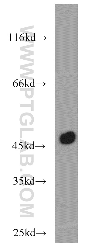 WB analysis of mouse pancreas using 15836-1-AP