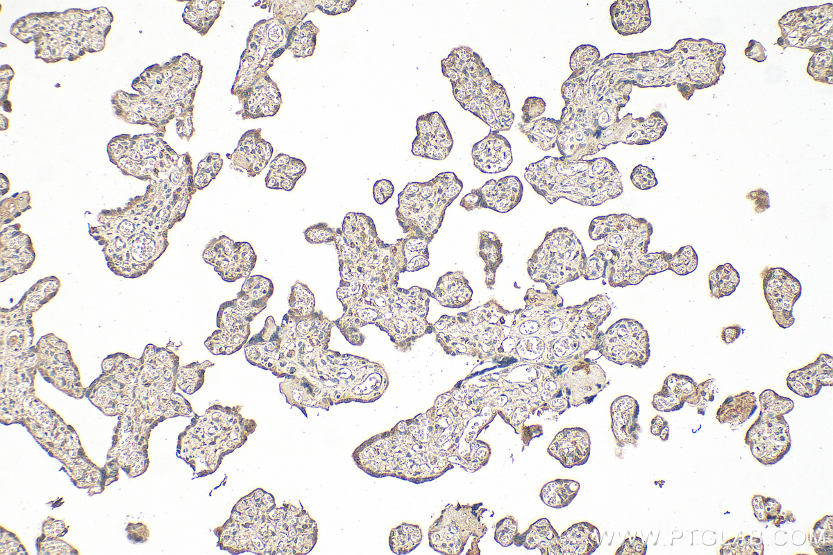 IHC staining of human placenta using 68826-1-Ig
