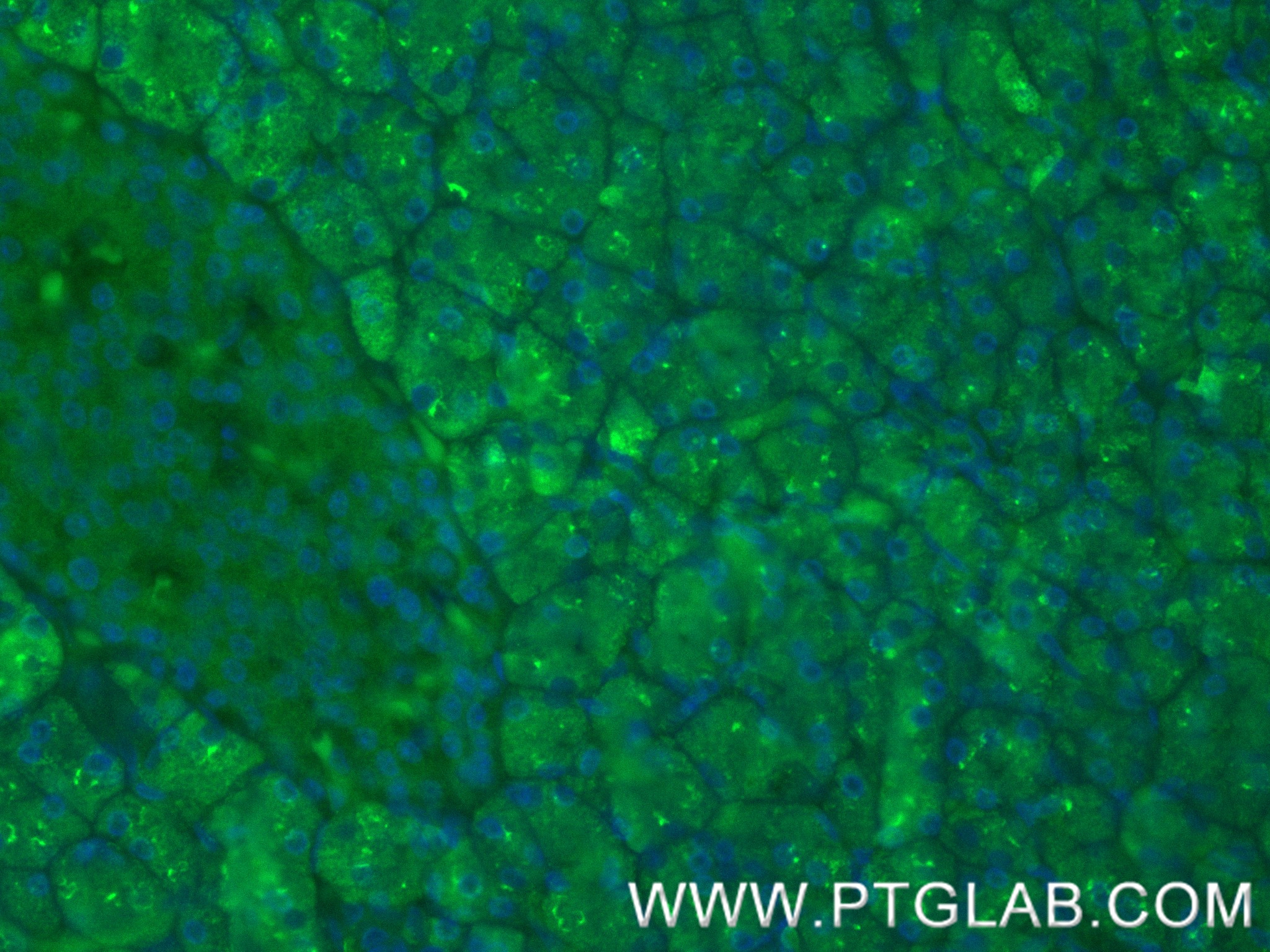 IF Staining of human pancreas using 88295-1-RR IF Staining of human pancreas using 88295-1-RR