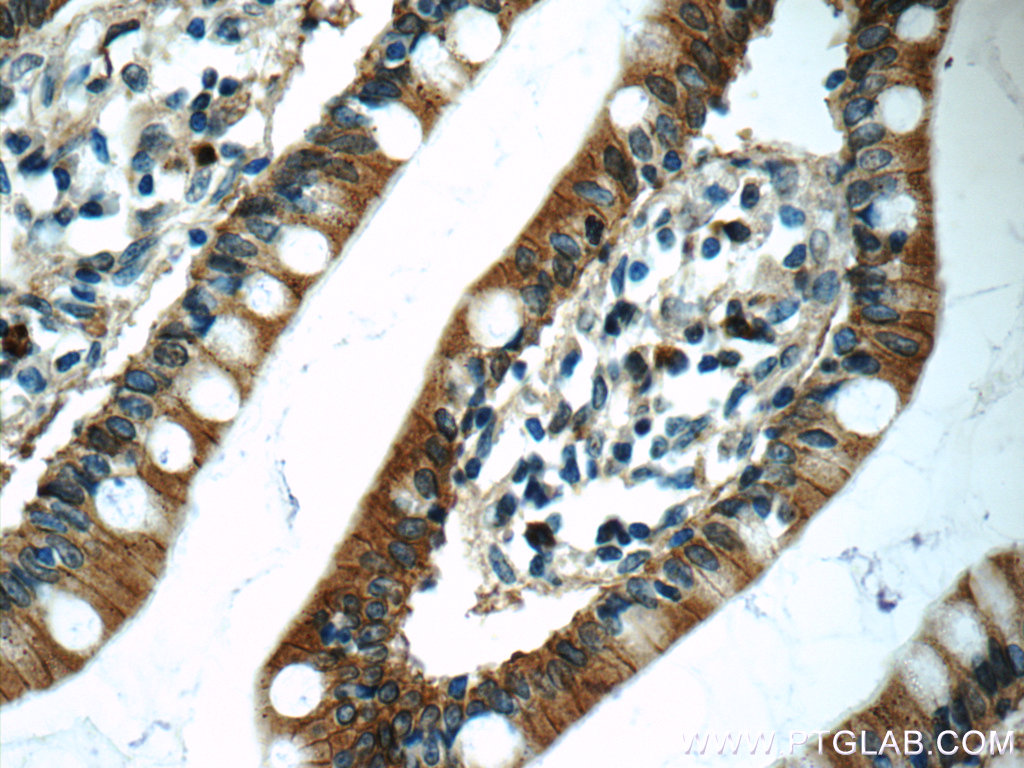 IHC staining of human small intestine using 16236-1-AP