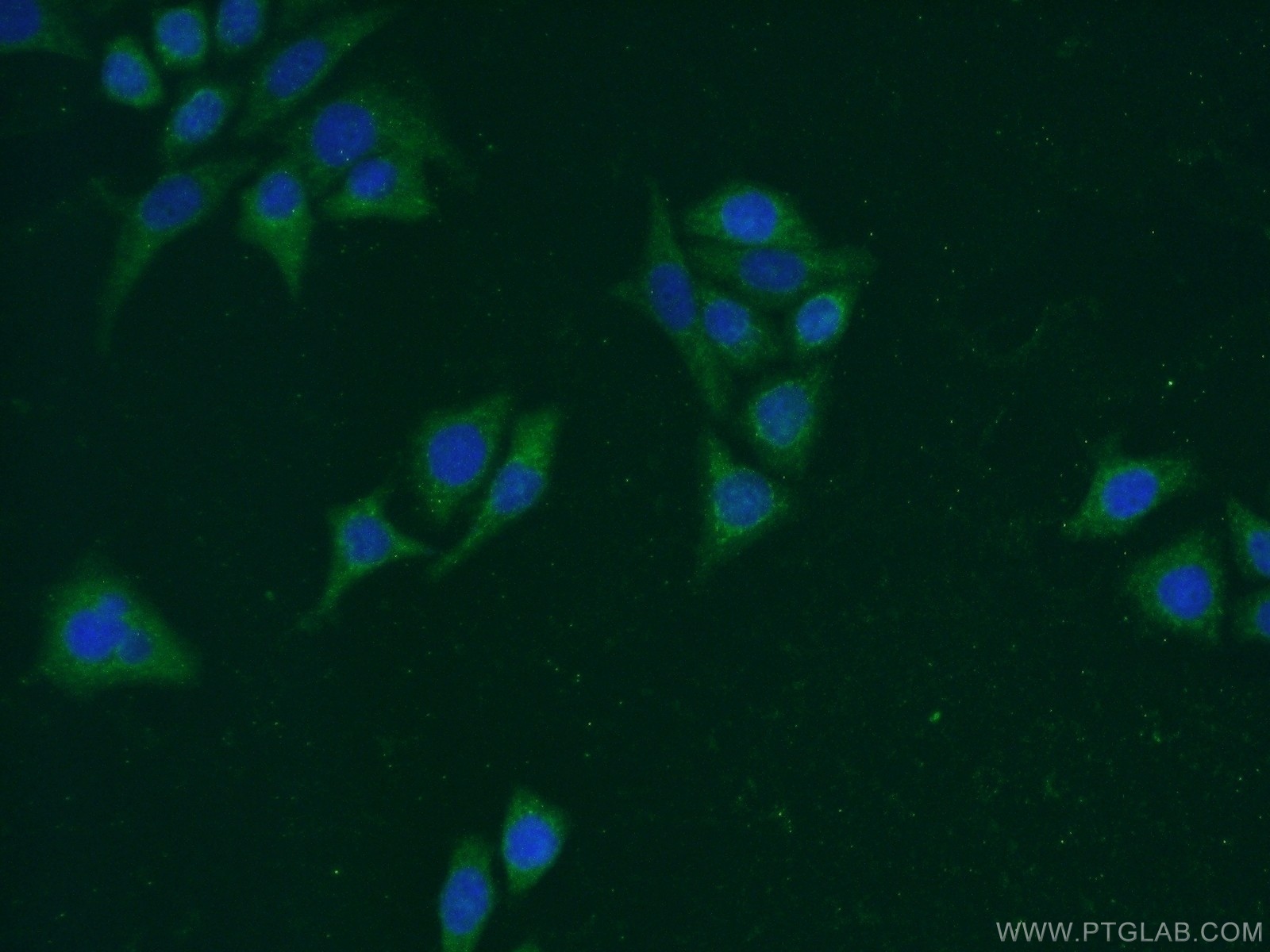 IF Staining of PC-3 using 13731-1-AP