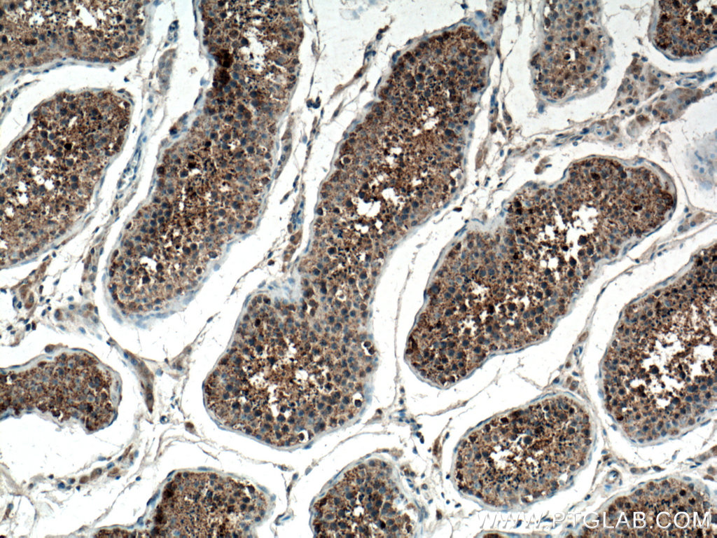 IHC staining of human testis using 13731-1-AP