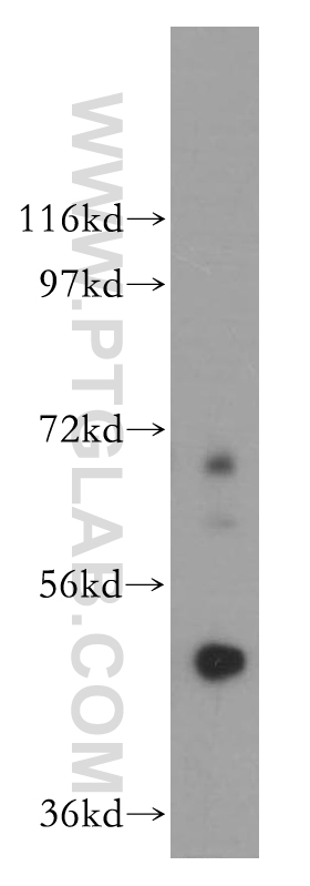 WB analysis of PC-3 using 13731-1-AP