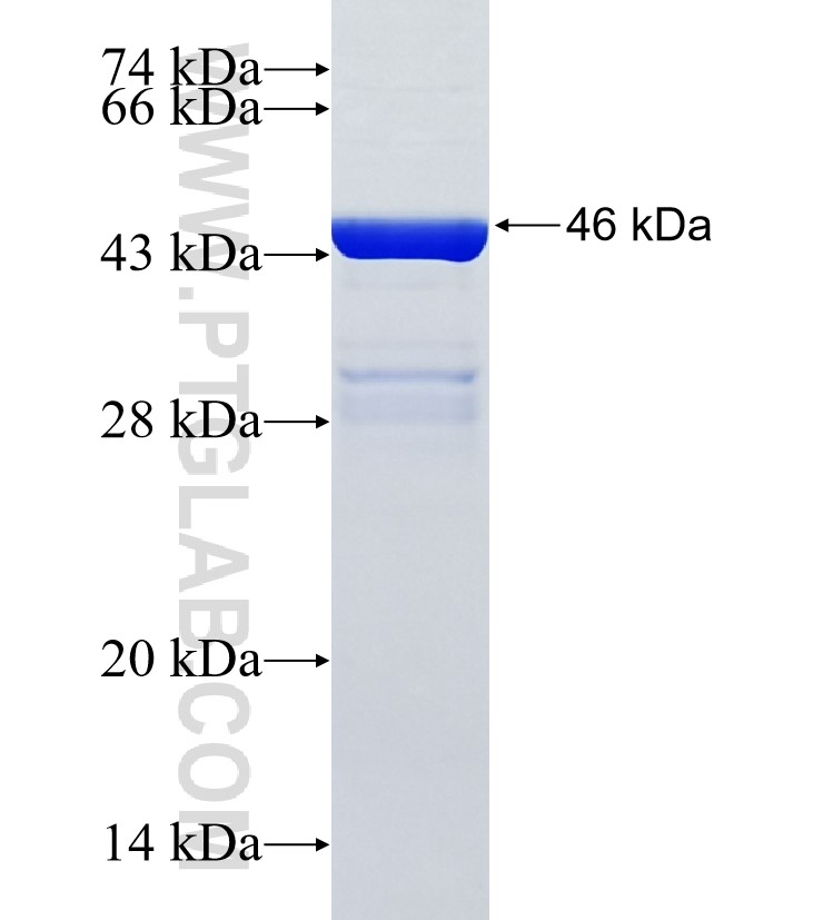 CPAMD8 fusion protein Ag35431 SDS-PAGE CPAMD8 fusion protein Ag35431 SDS-PAGE