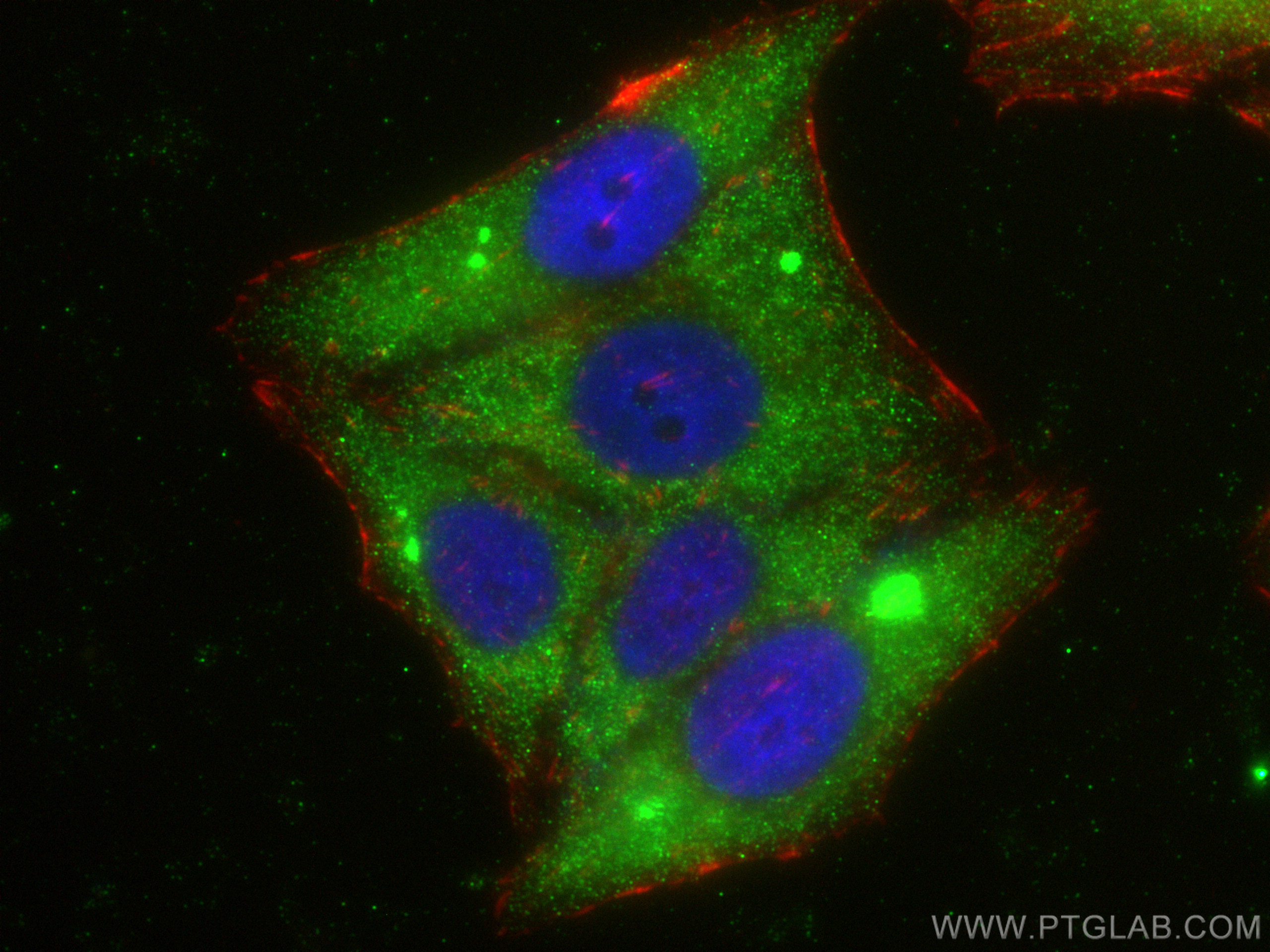 IF Staining of HepG2 using 13710-1-AP