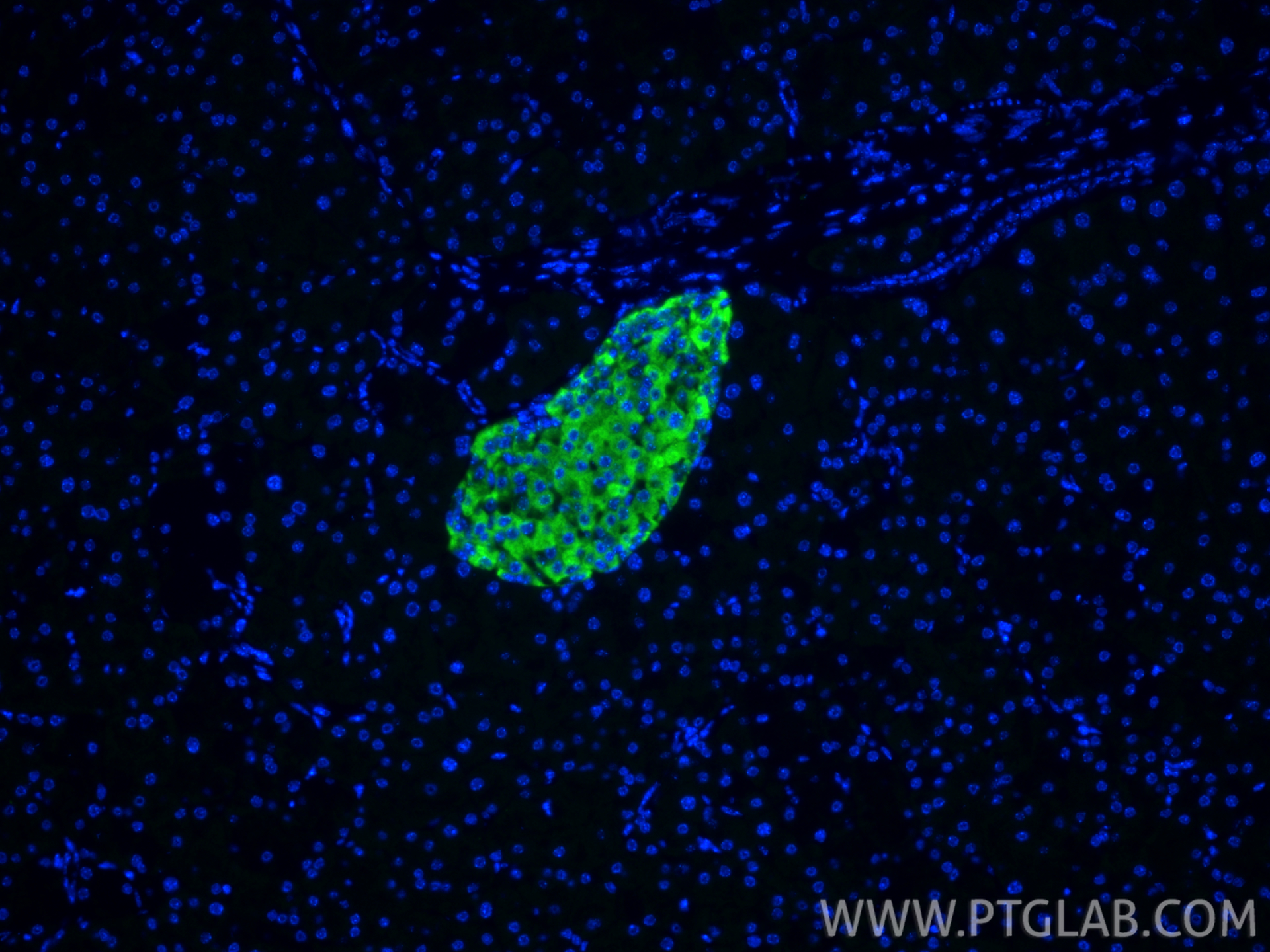 IF Staining of mouse pancreas using 13710-1-AP