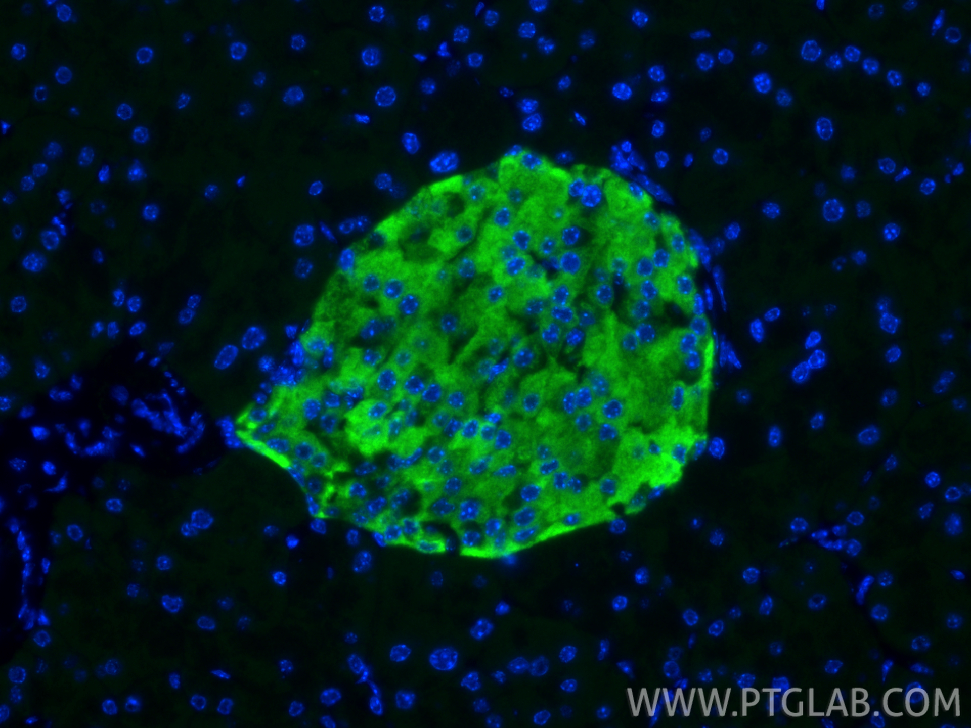 IF Staining of mouse pancreas using 13710-1-AP