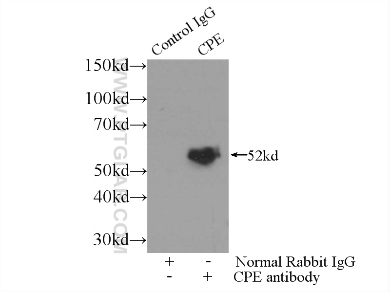 IP experiment of mouse brain using 13710-1-AP