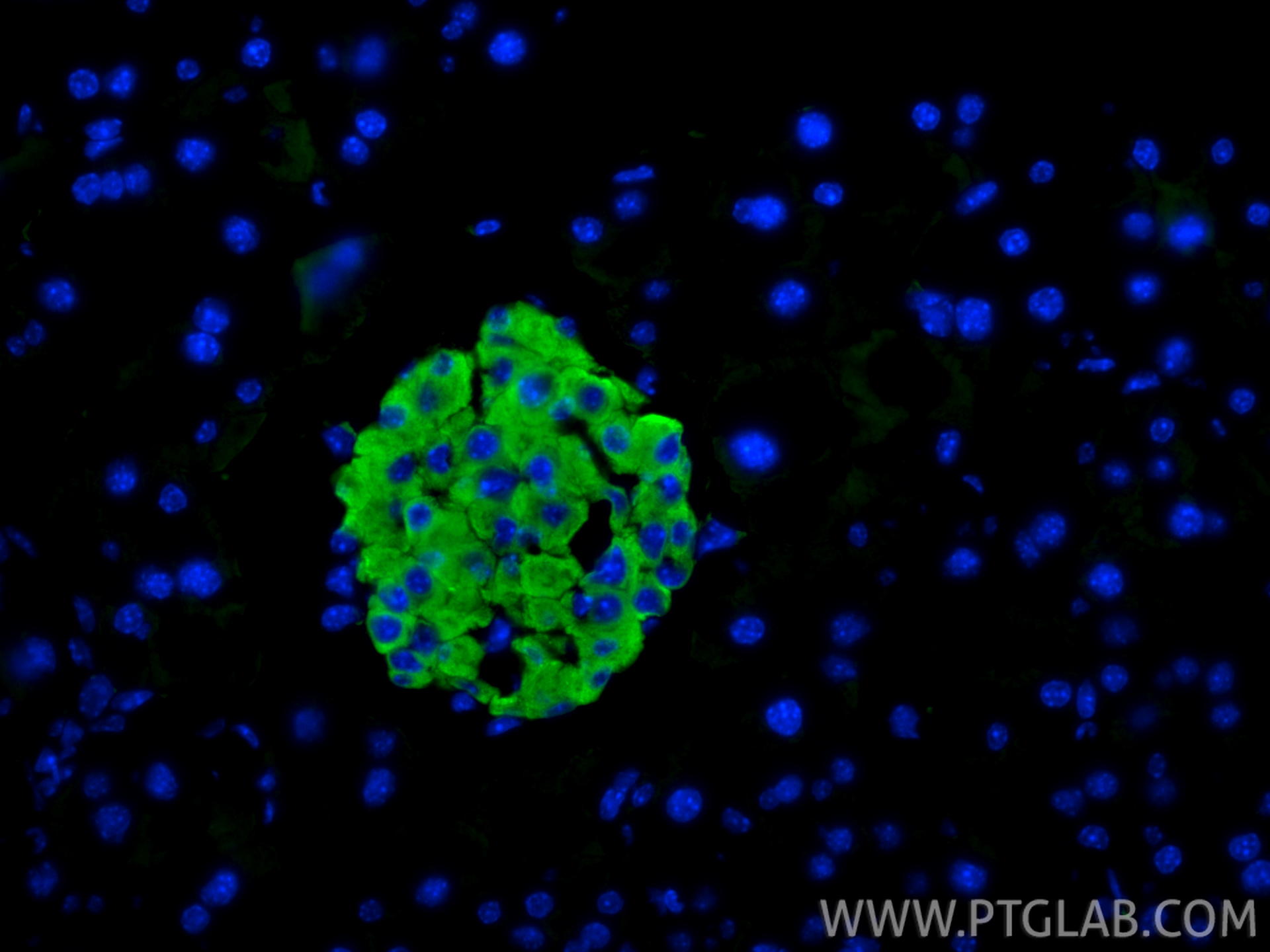 IF Staining of mouse pancreas using RMX00074 IF Staining of mouse pancreas using RMX00074