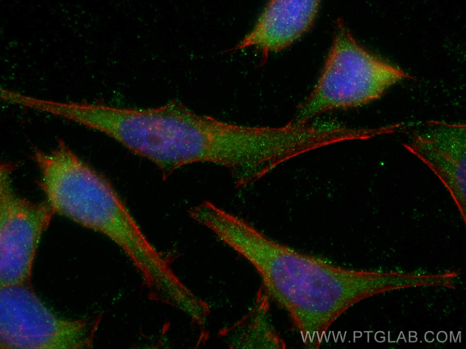 IF Staining of HeLa using 13274-1-AP