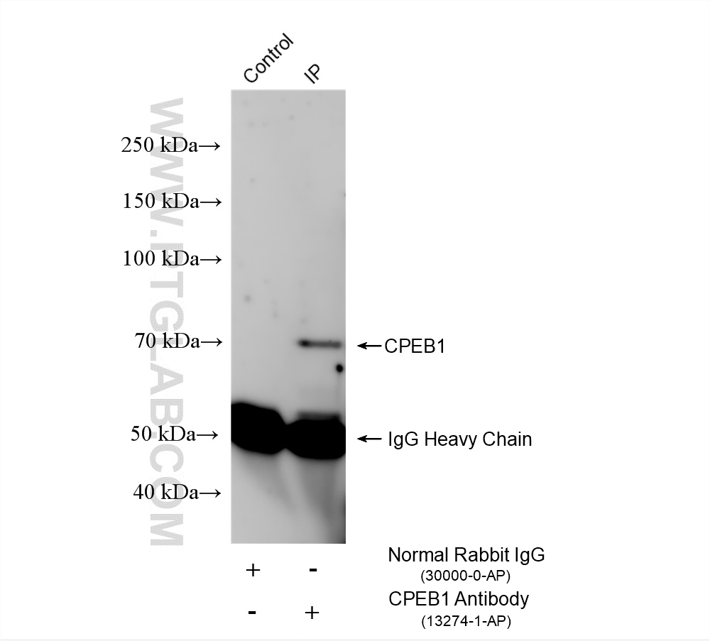 IP experiment of Neuro-2a using 13274-1-AP