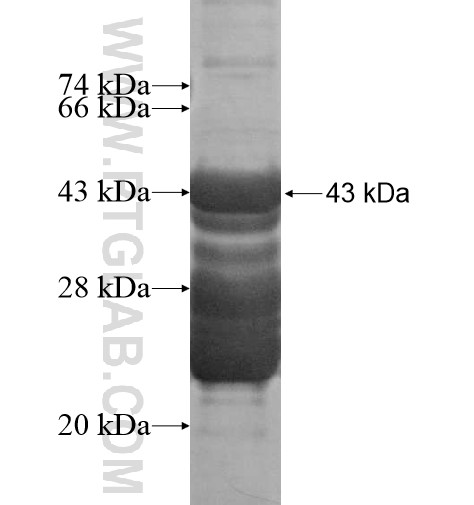 CPEB2 fusion protein Ag16063 SDS-PAGE CPEB2 fusion protein Ag16063 SDS-PAGE