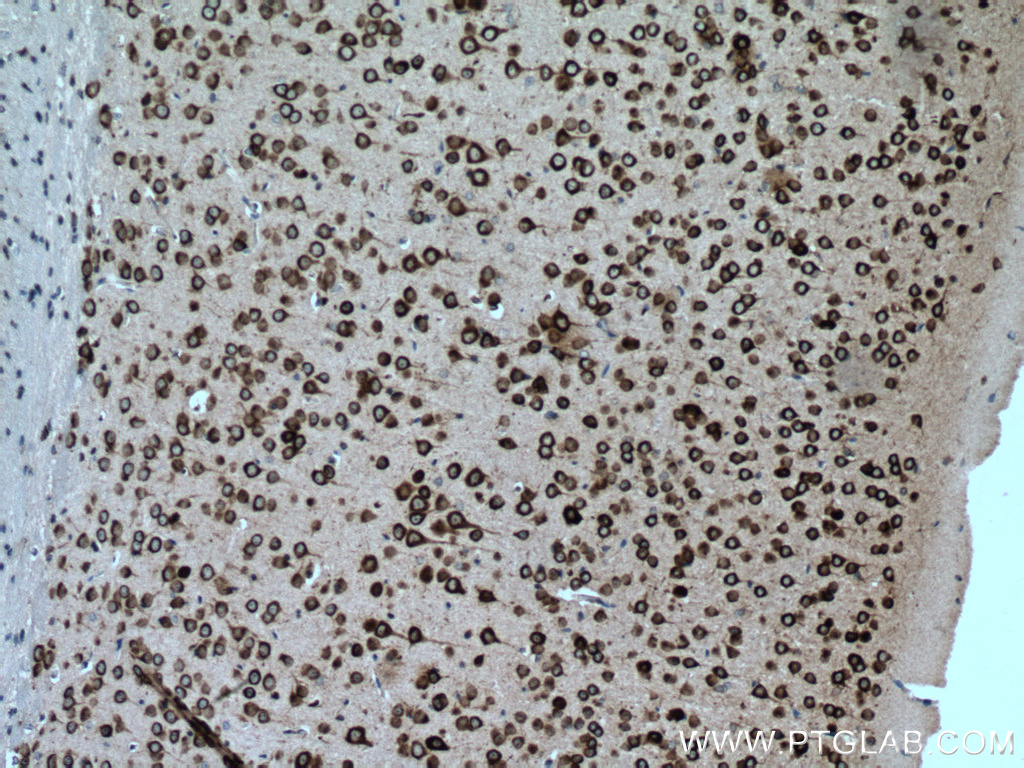 IHC staining of mouse brain using 12669-1-AP