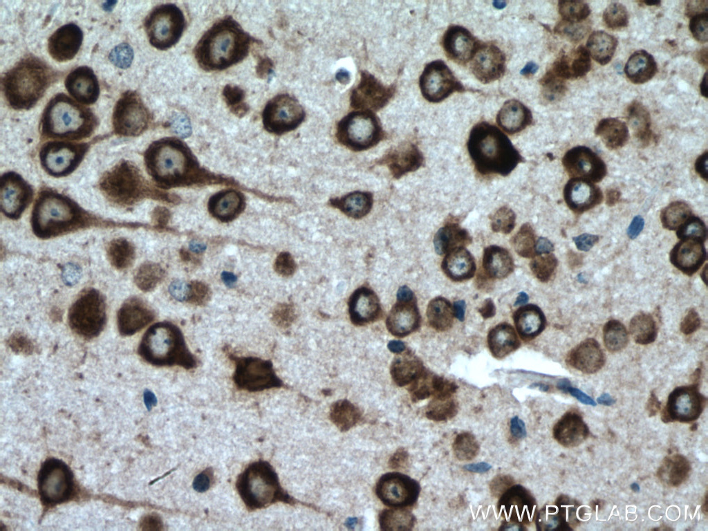 IHC staining of mouse brain using 12669-1-AP