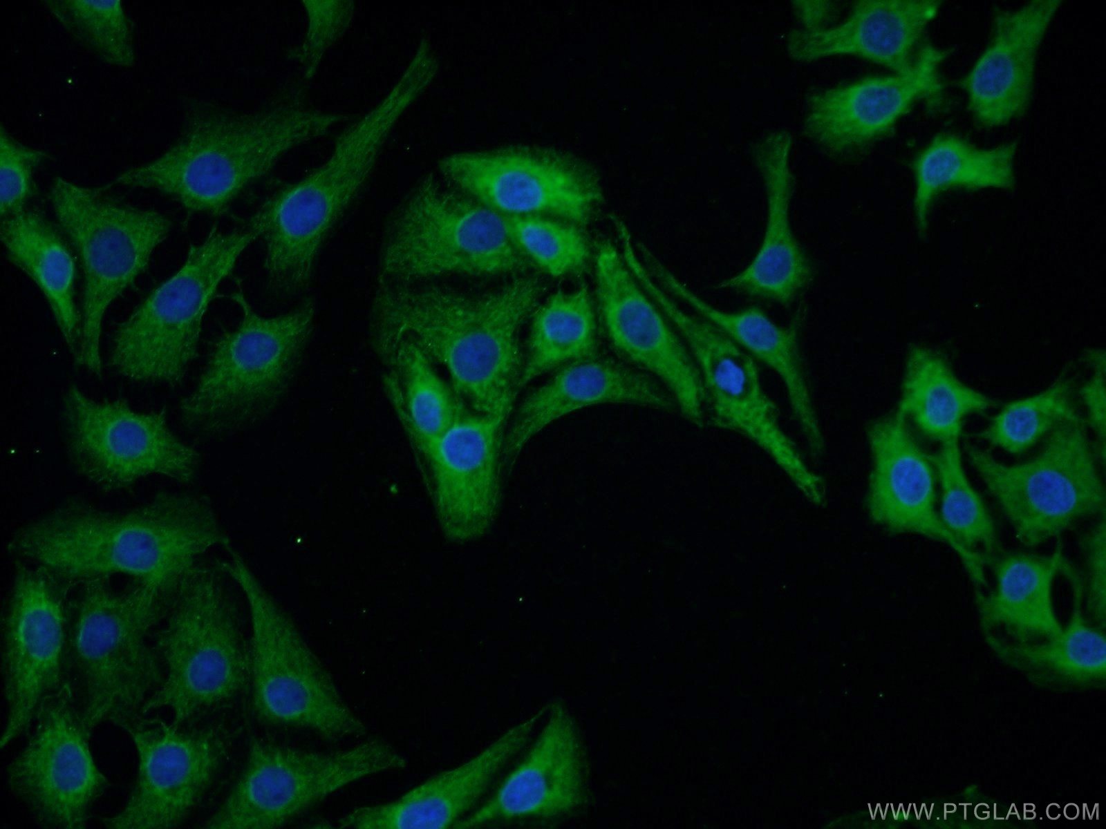 IF Staining of SH-SY5Y using 10246-2-AP