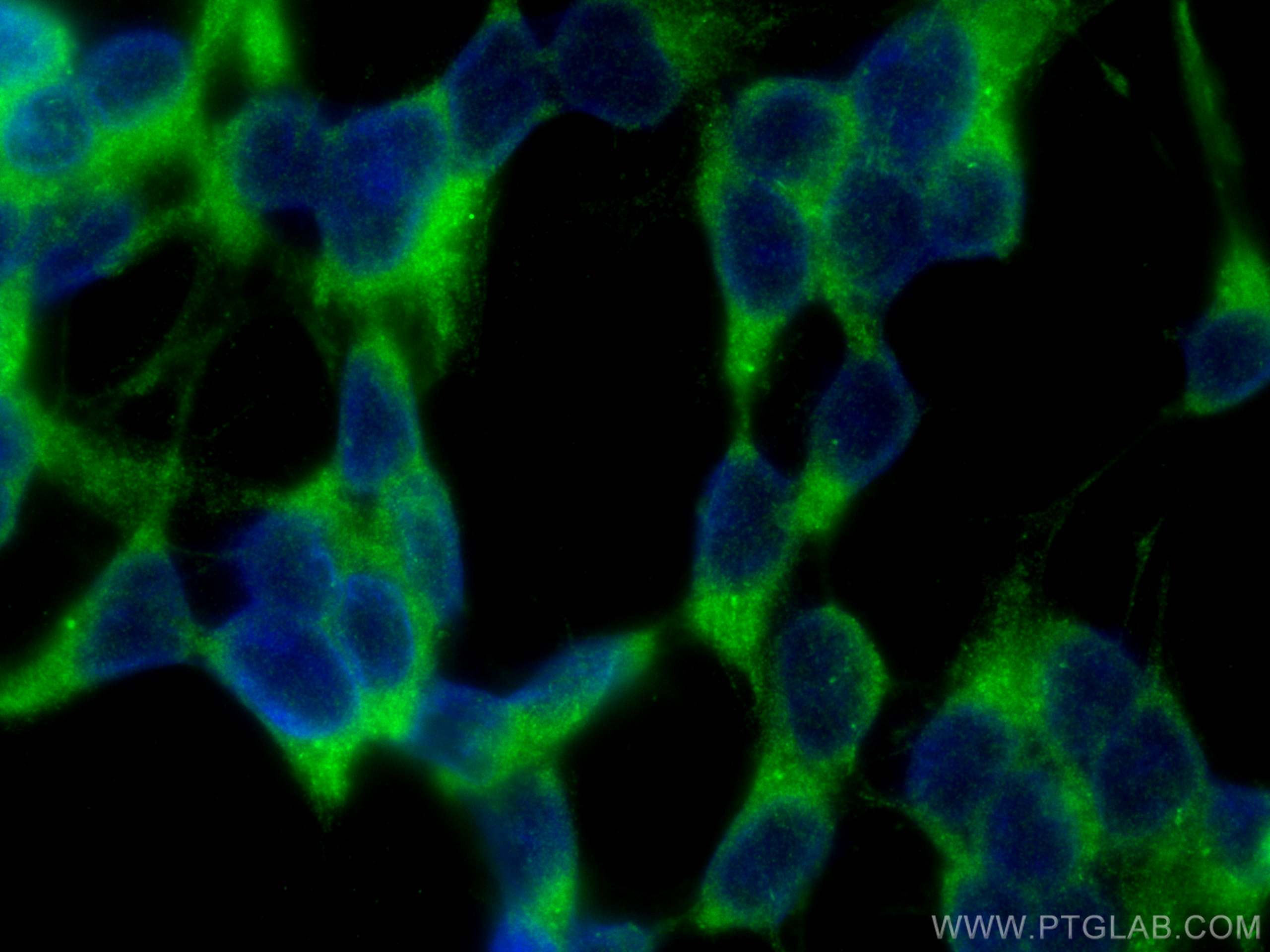 IF Staining of SH-SY5Y using 10246-2-AP