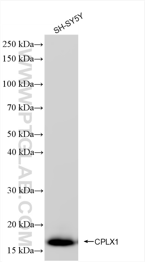 WB analysis of SH-SY5Y using 85874-1-RR (same clone as 85874-1-PBS)