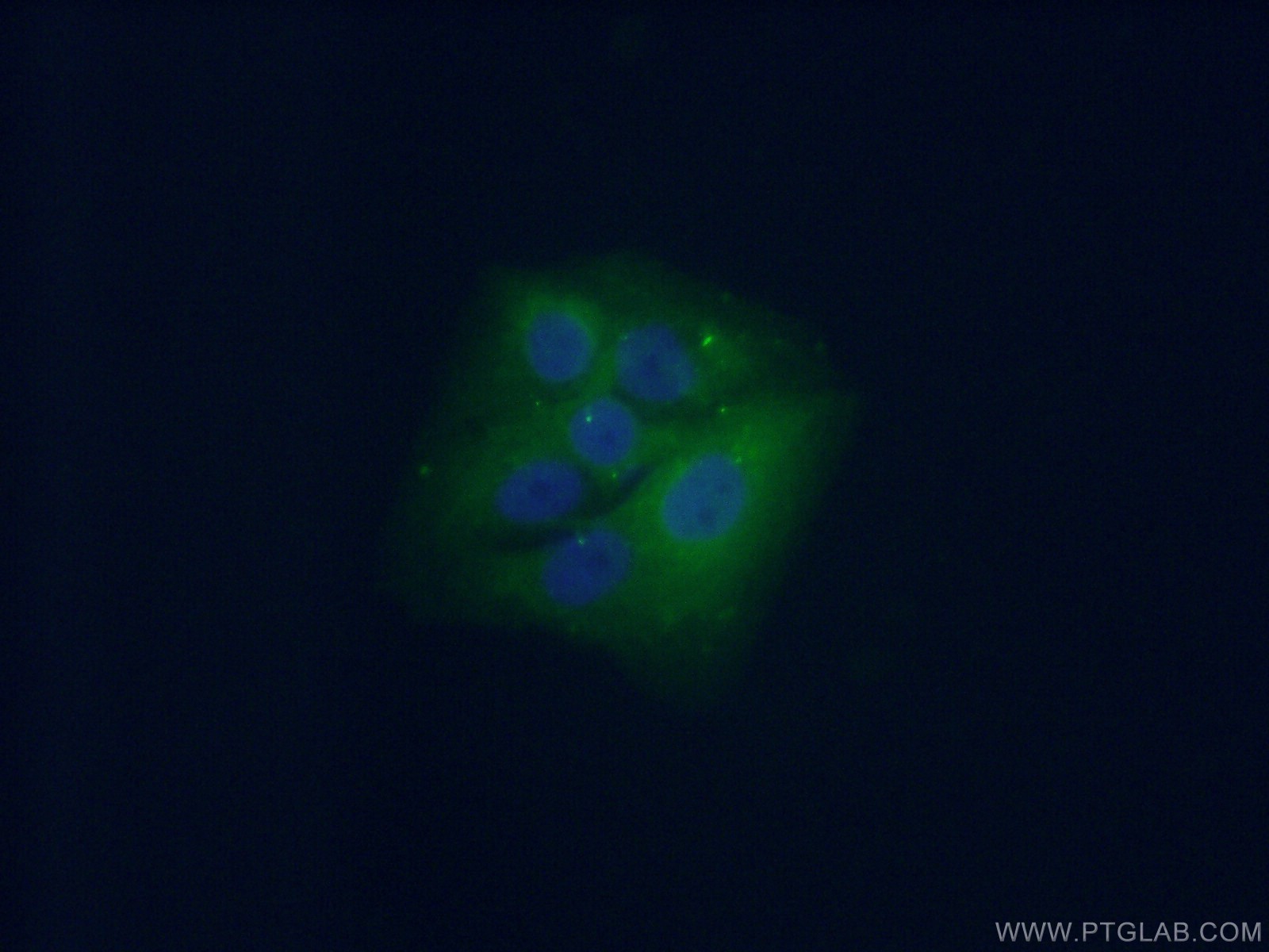 IF Staining of A549 using 18149-1-AP