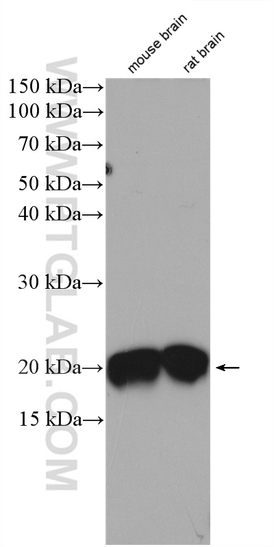 WB analysis of mouse brain using 18149-1-AP