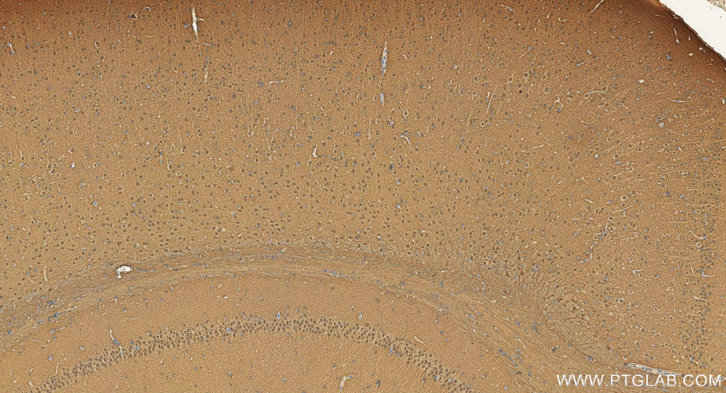 IHC staining of mouse brain using 20249-1-AP IHC staining of mouse brain using 20249-1-AP