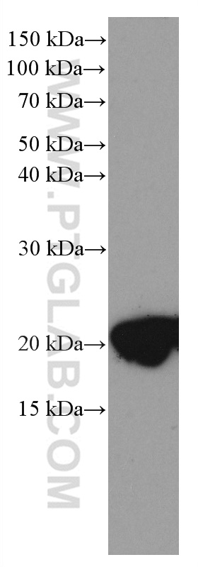 WB analysis of mouse brain using 66849-1-Ig