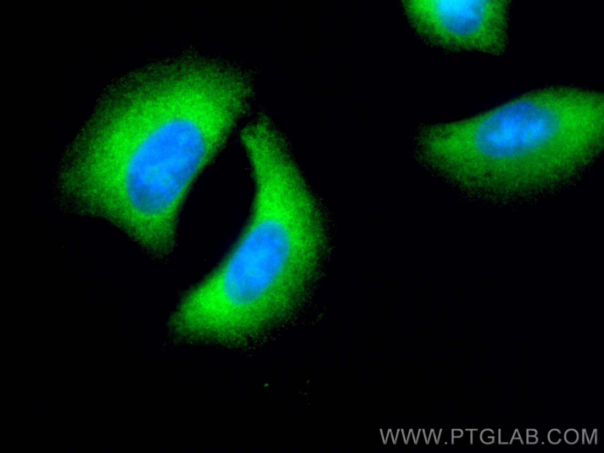 IF Staining of A549 using CL488-18149