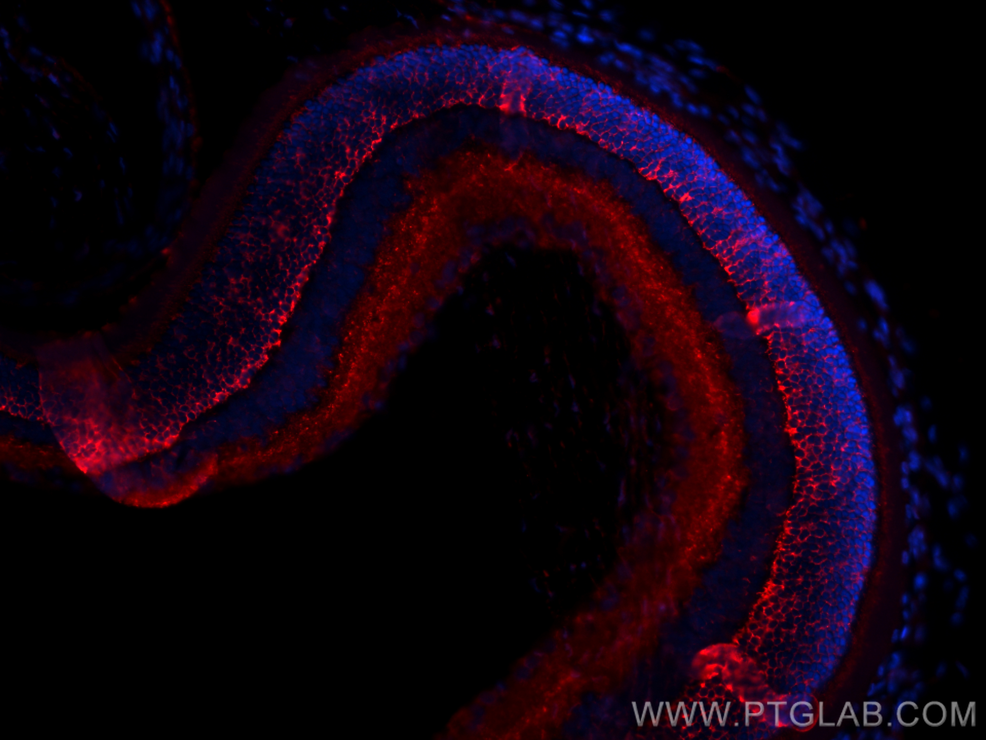 IF Staining of rat eye using 21222-1-AP