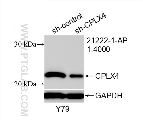 WB analysis of Y79 using 21222-1-AP