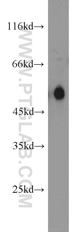 WB analysis of HEK-293 using 16440-1-AP