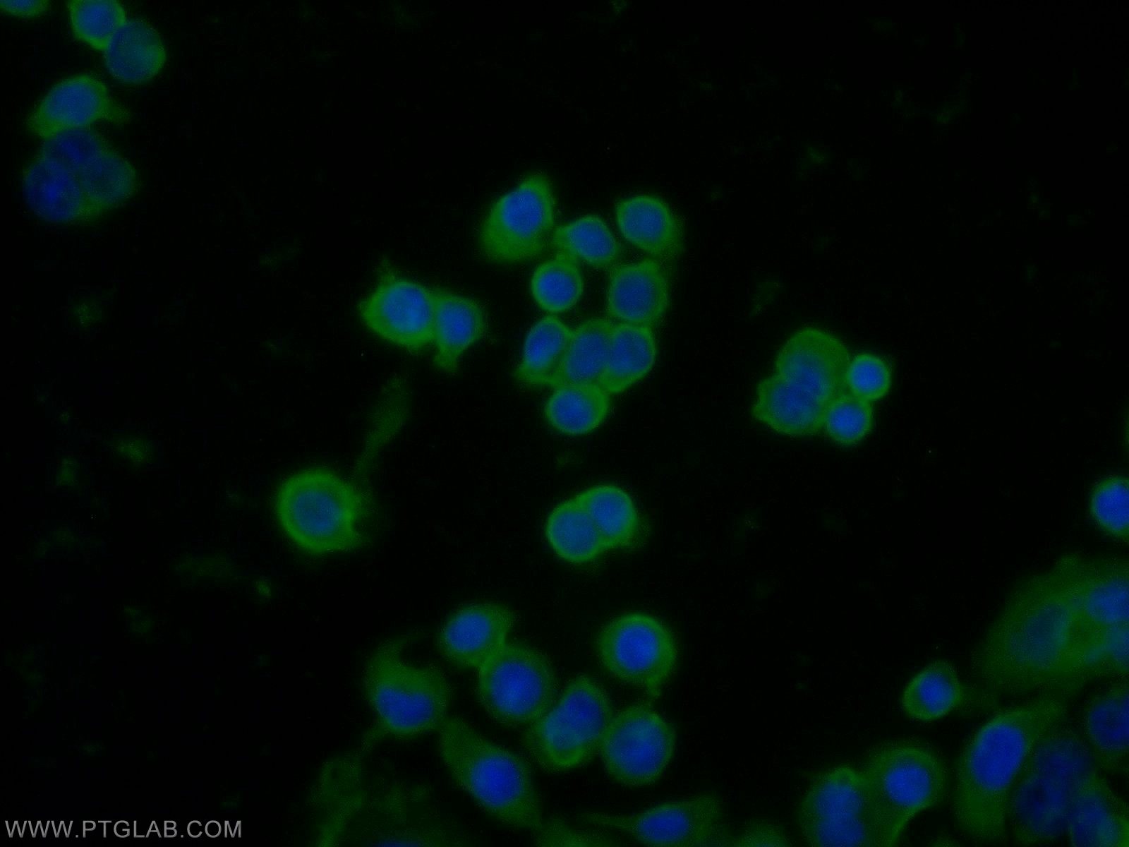 IF Staining of COLO 320 using 13385-1-AP