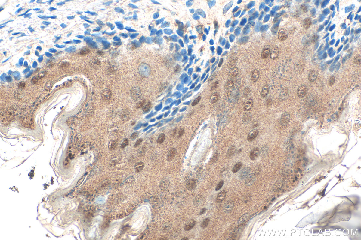 IHC staining of rat stomach using 10126-2-AP