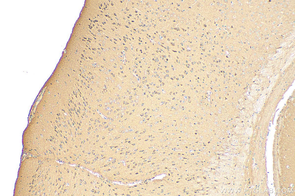 IHC staining of mouse brain using 17664-1-AP