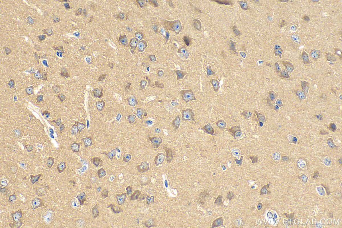 IHC staining of mouse brain using 17664-1-AP