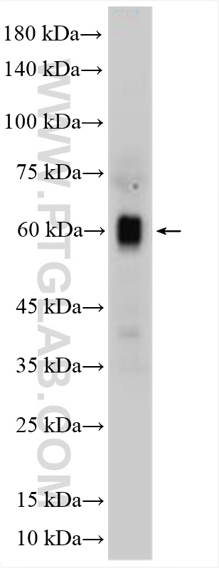 WB analysis of mouse brain using 17664-1-AP