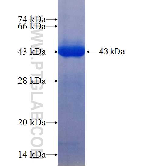 CPNE2 fusion protein Ag12160 SDS-PAGE CPNE2 fusion protein Ag12160 SDS-PAGE