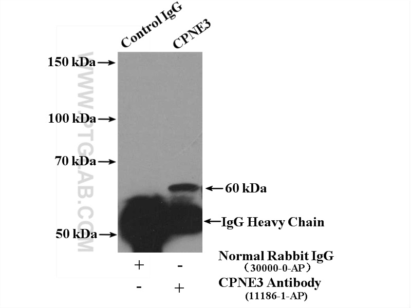 IP experiment of HepG2 using 11186-1-AP