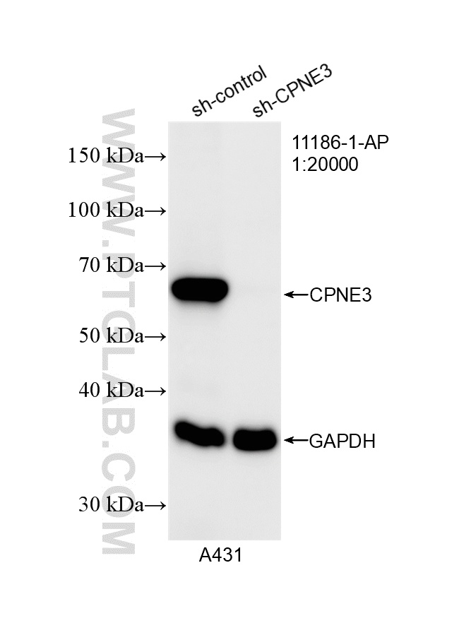 WB result of CPNE3 antibody (11186-1-AP; 1:20000; incubated at room temperature for 1.5 hours) with sh-Control and sh-CPNE3 transfected A431 cells. WB analysis of A431 using 11186-1-AP