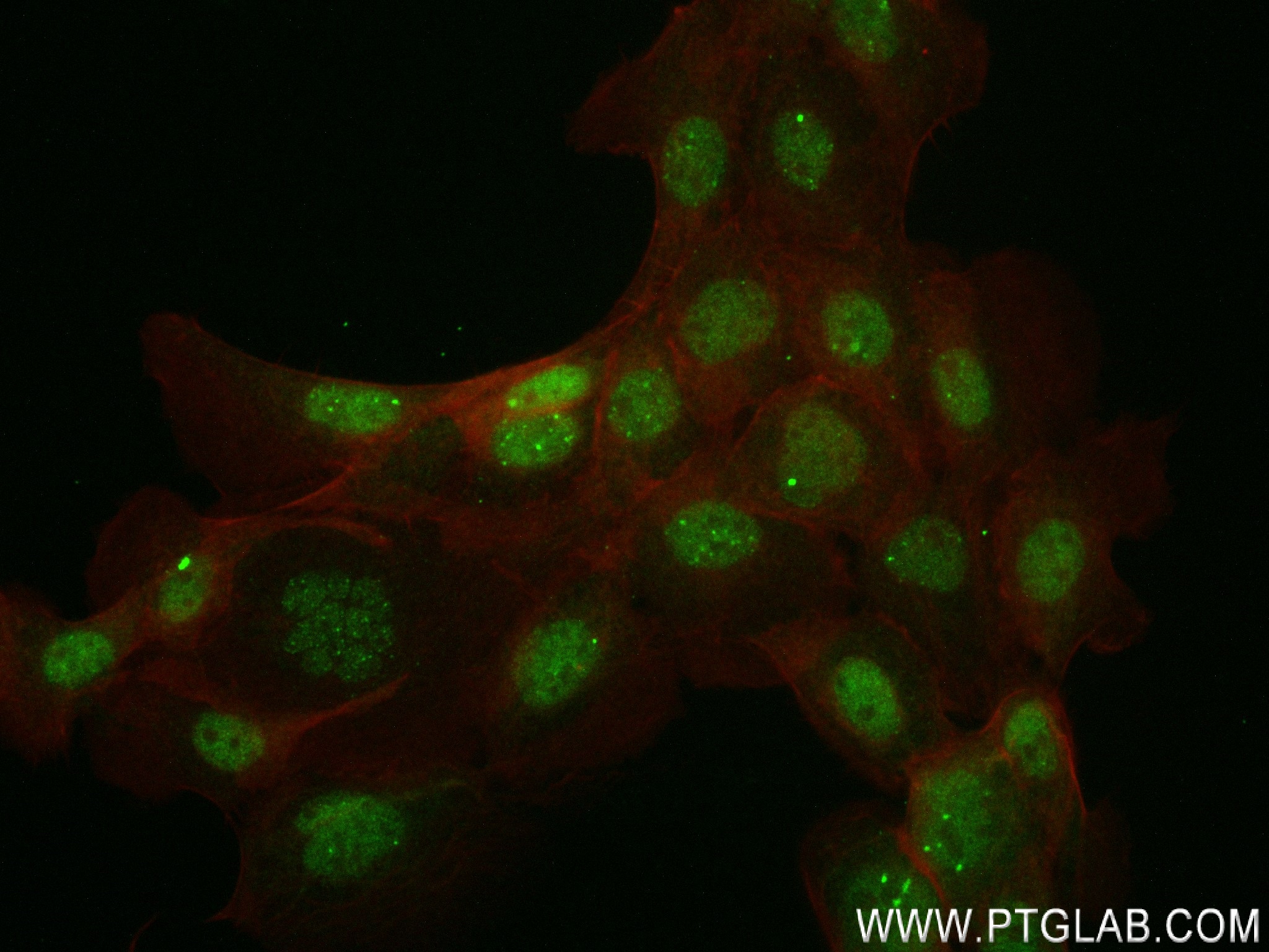 IF Staining of A431 using 83820-5-RR