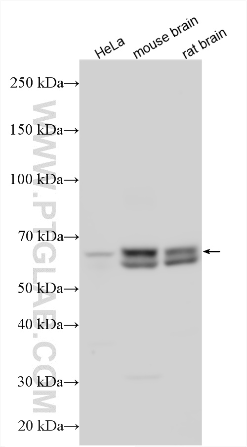 WB analysis using 16075-1-AP