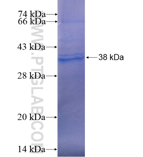 CPNE6 fusion protein Ag5042 SDS-PAGE CPNE6 fusion protein Ag5042 SDS-PAGE
