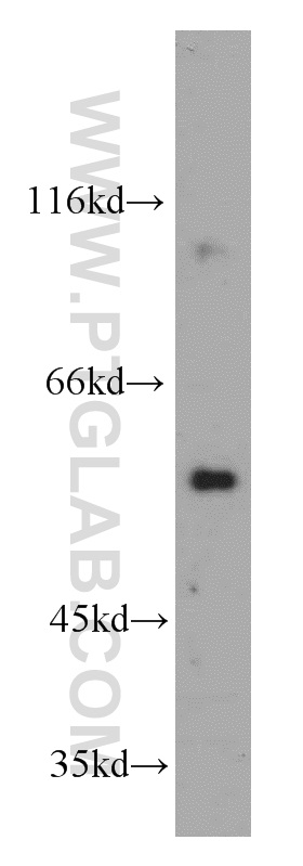 WB analysis of mouse brain using 20098-1-AP