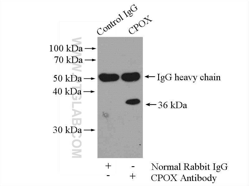 IP experiment of HepG2 using 12211-1-AP