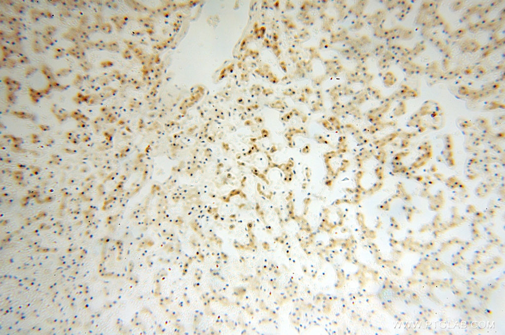IHC staining of human liver using 16724-1-AP