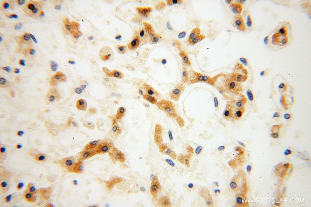 IHC staining of human liver using 16724-1-AP