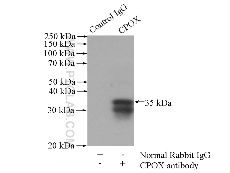 IP experiment of HepG2 using 16724-1-AP