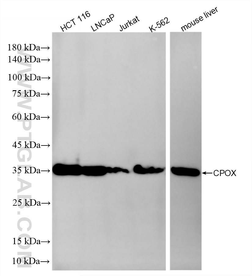 WB analysis using 87270-2-RR
