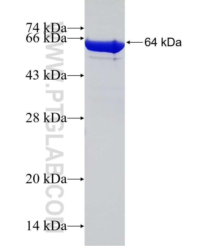 CPOX fusion protein Ag10164 SDS-PAGE