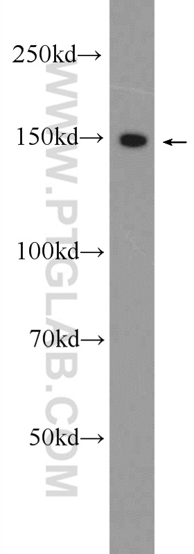 CPS1 Polyclonal antibody